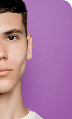 Acne Treatment — After