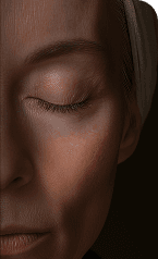 Anti Aging Treatments — After