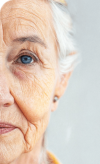 Anti Aging Treatments — Before