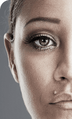 Dermabrasion — Before