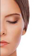 Hydra Facial — After
