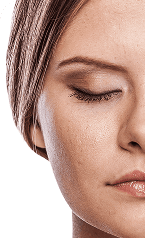 Hydra Facial — Before