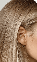 Scalp Analysis — After