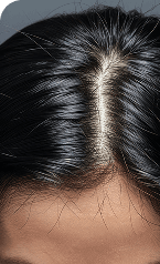 Scalp Analysis — Before