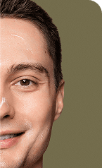 Signature Facial — After