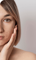 Skin Care — Before