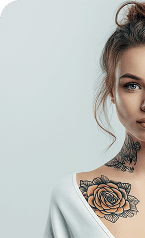 Tattoo Removal — Before