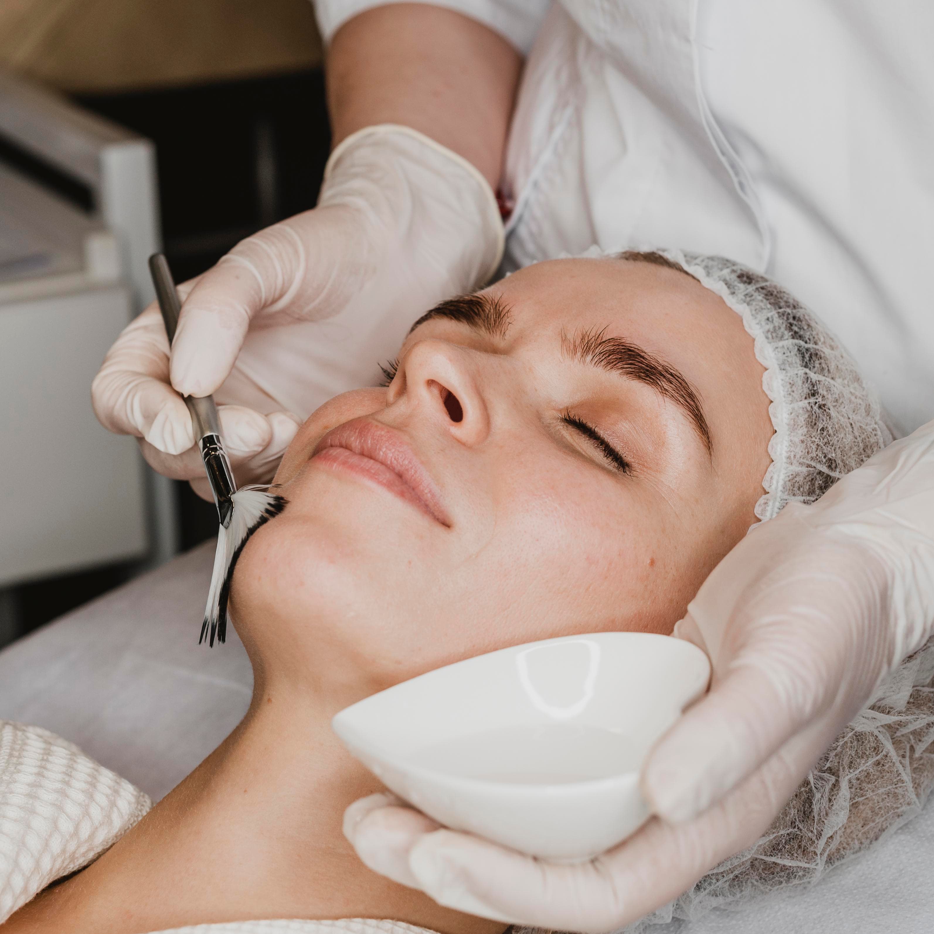 Acne Treatment
