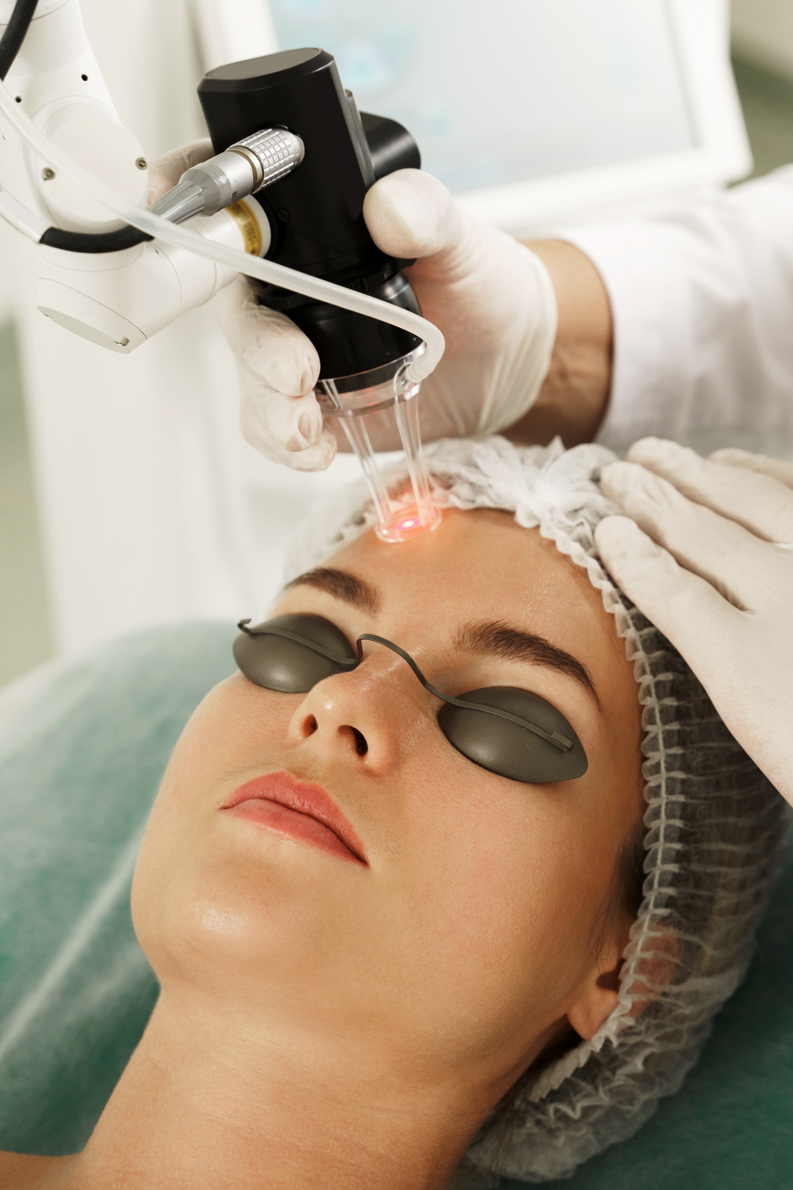 Laser Skin Treatment
