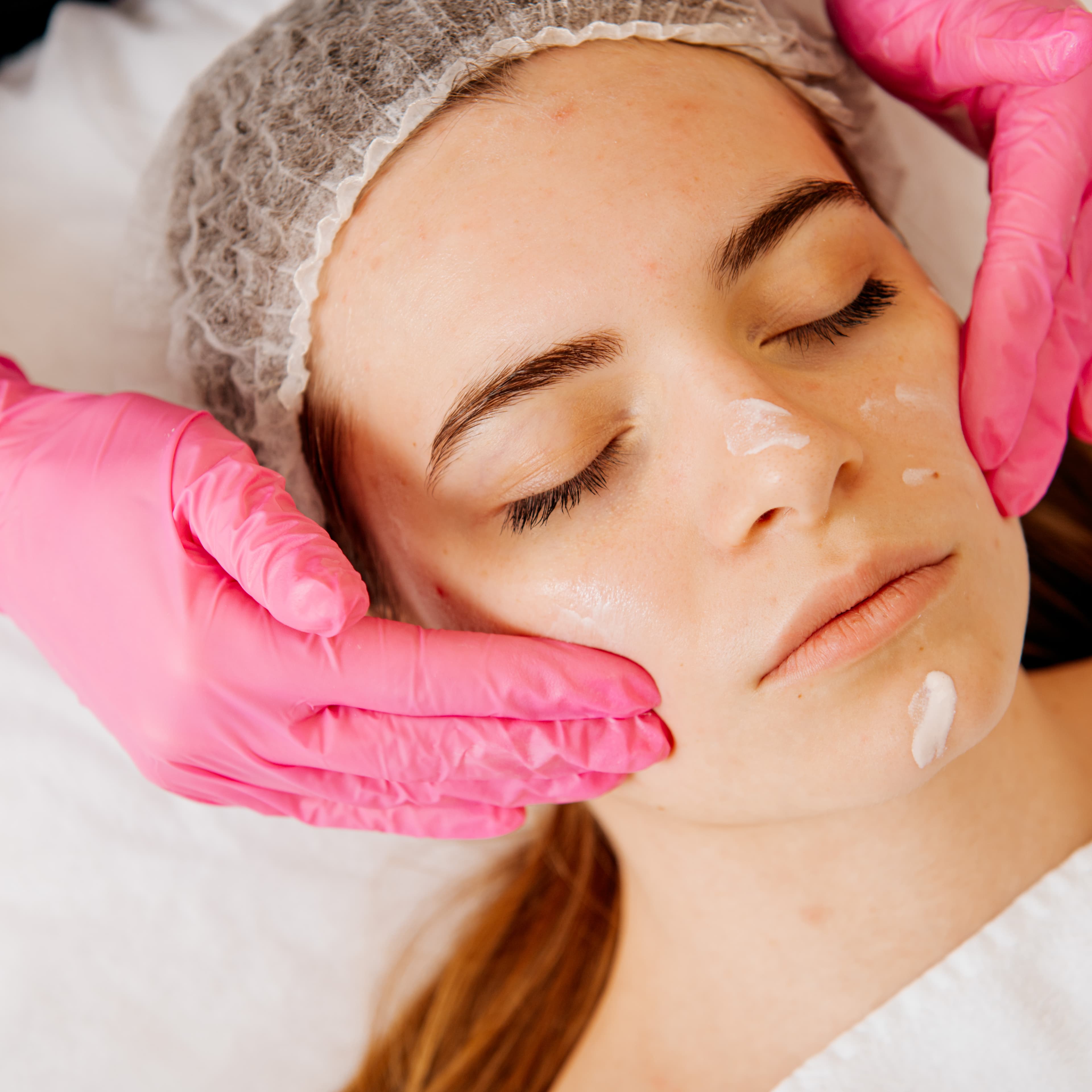 Skin Preparation